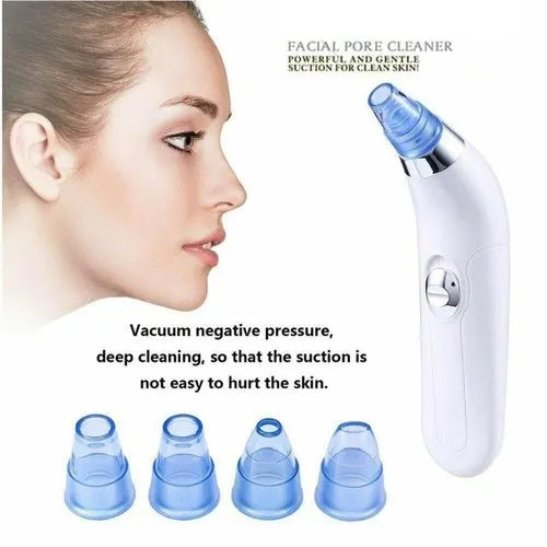 Blackhead Suction Remover – Smooth Skin!