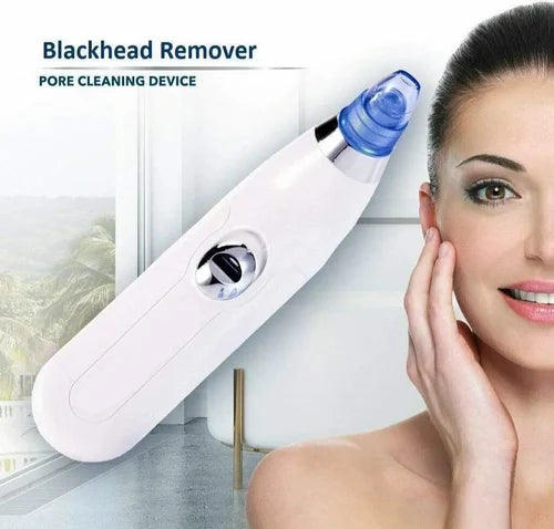 Blackhead Suction Remover – Smooth Skin!