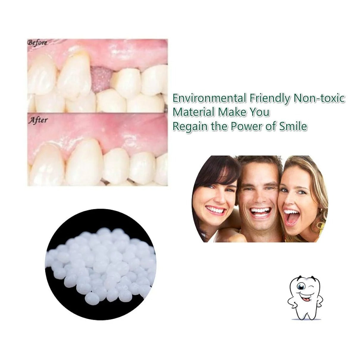 Moldable False Teeth