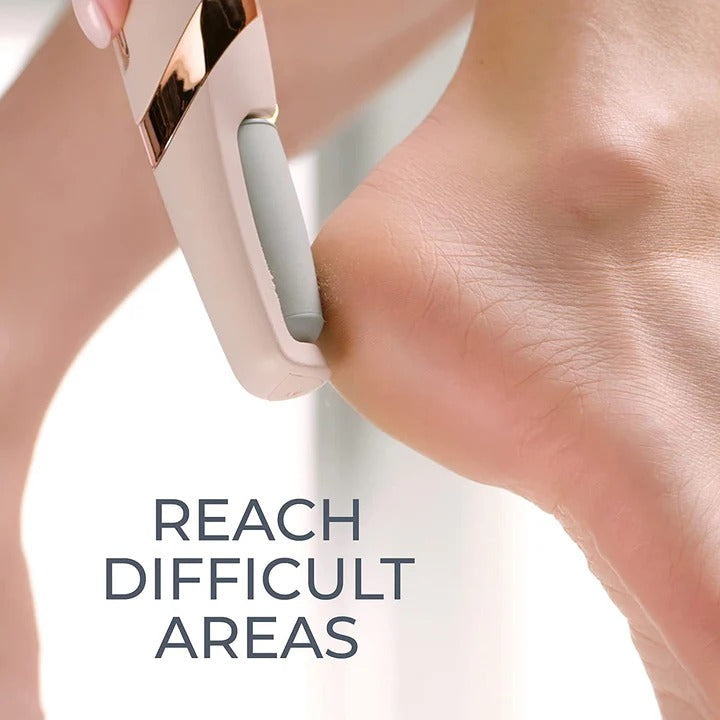 Callus Remover