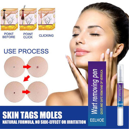 Warts Remover Original Cream (Original)