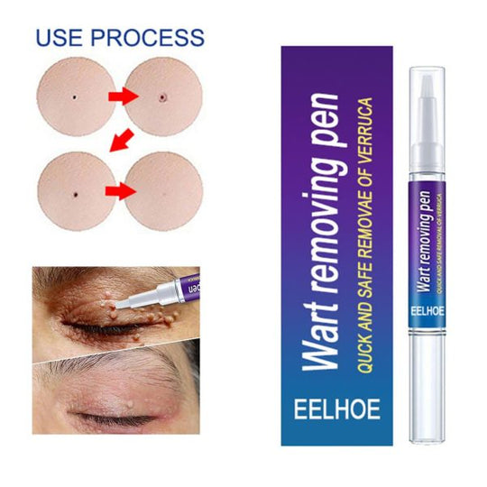 Warts Remover Original Cream (Original)